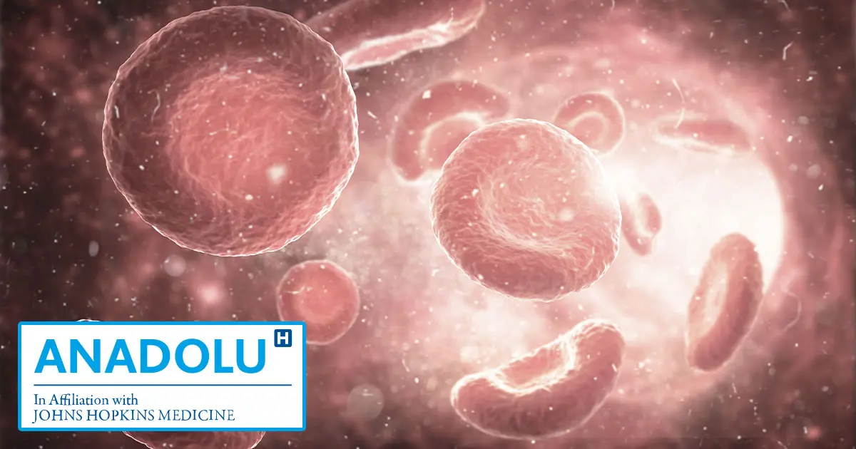 Soigner les cancers hématologiques (du sang) par la greffe de la moelle osseuse