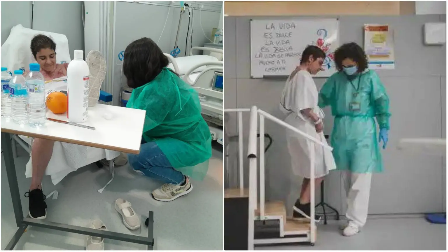 Exclusivité Algérie360 : brûlée par son voisin, appel de Ryma Anane pour poursuivre ses soins à Madrid