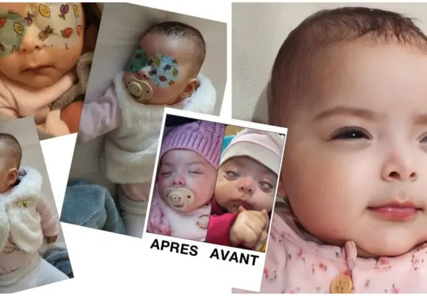 Béjaïa : l&rsquo;élan de solidarité des Algériens sur le net sauve la petite Miral de la cécité