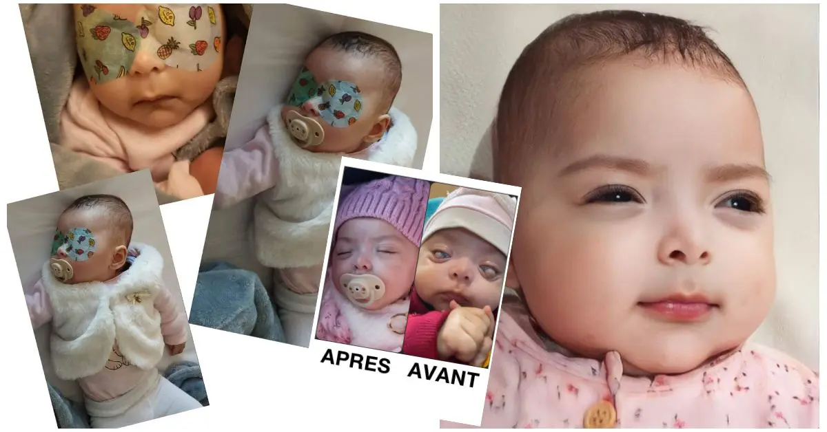 Béjaïa : l’élan de solidarité des Algériens sur le net sauve la petite Miral de la cécité