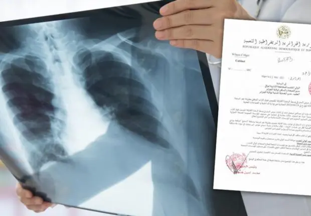 Cas de tuberculose parmi des subsahariens à Blida : les autorités algériennes alertent