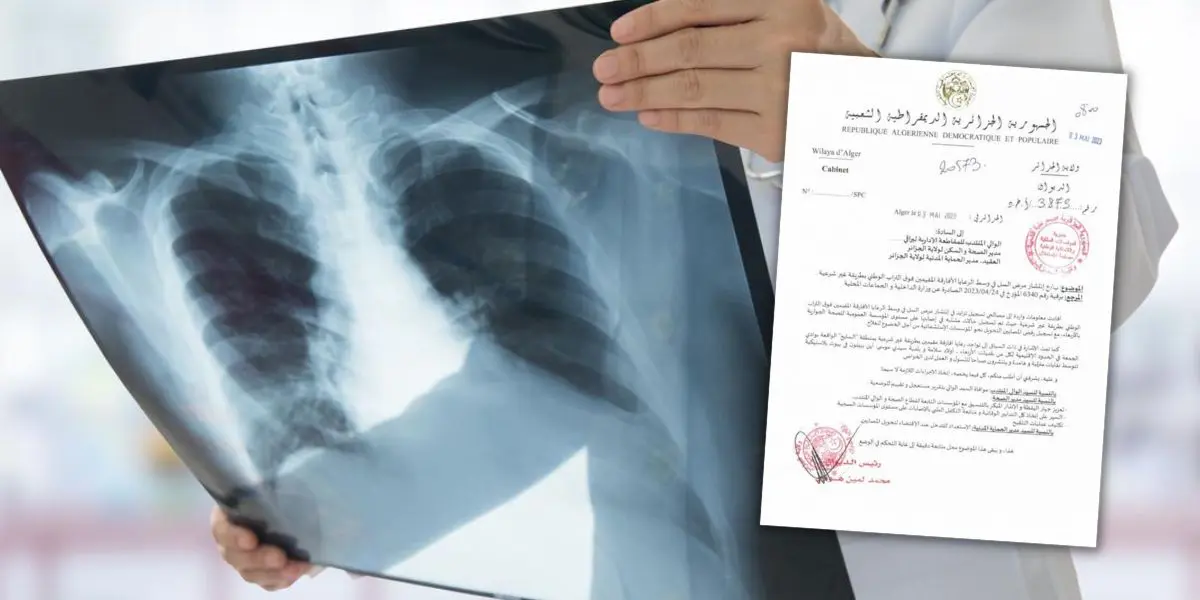 Cas de tuberculose parmi des subsahariens à Blida : les autorités algériennes alertent