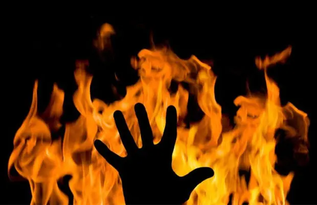 Une femme brûlée par son voisin à Khenchela