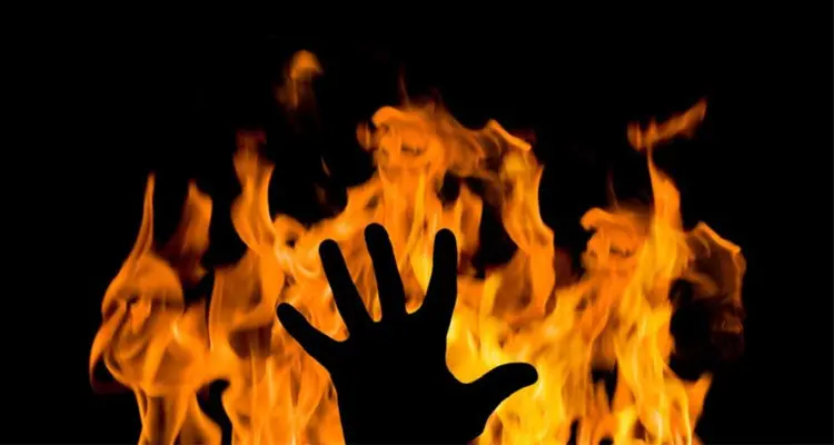 Une femme brûlée par son voisin à Khenchela