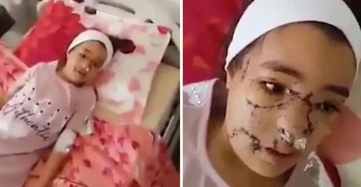 Une petite fille victime d’une attaque de pitbull à Boumerdes