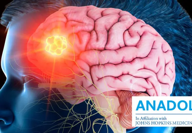 Que savez-vous sur le MÉNINGIOME, la tumeur du cerveau la plus courante ?