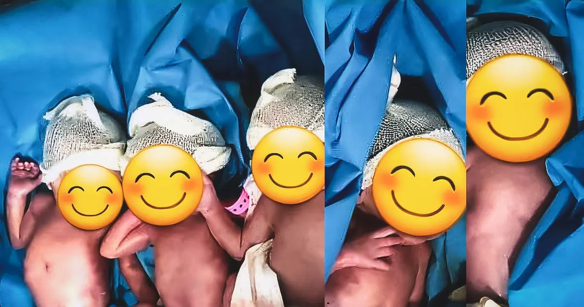 [ÉVÉNEMENT RARISSIME] Naissance de quintuplés au CHU Mustapha (Alger)