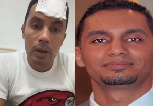 L&rsquo;hypnotiseur Walid Messili sauvagement agressé à Alger