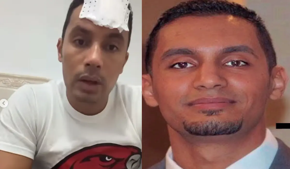 L’hypnotiseur Walid Messili sauvagement agressé à Alger