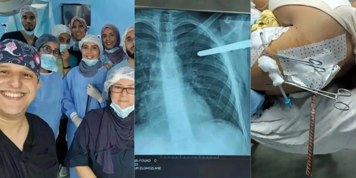 L’équipe médicale du CHU Mustapha sauve un adolescent transpercé par une barre métallique (IMAGES)