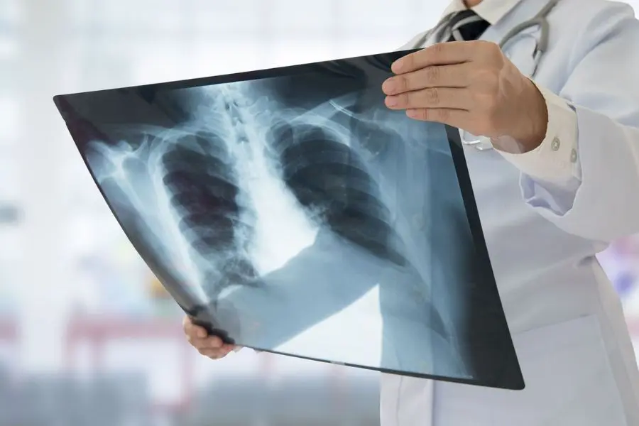 Le traitement du sarcome des tissus mous au Centre Médical Anadolu