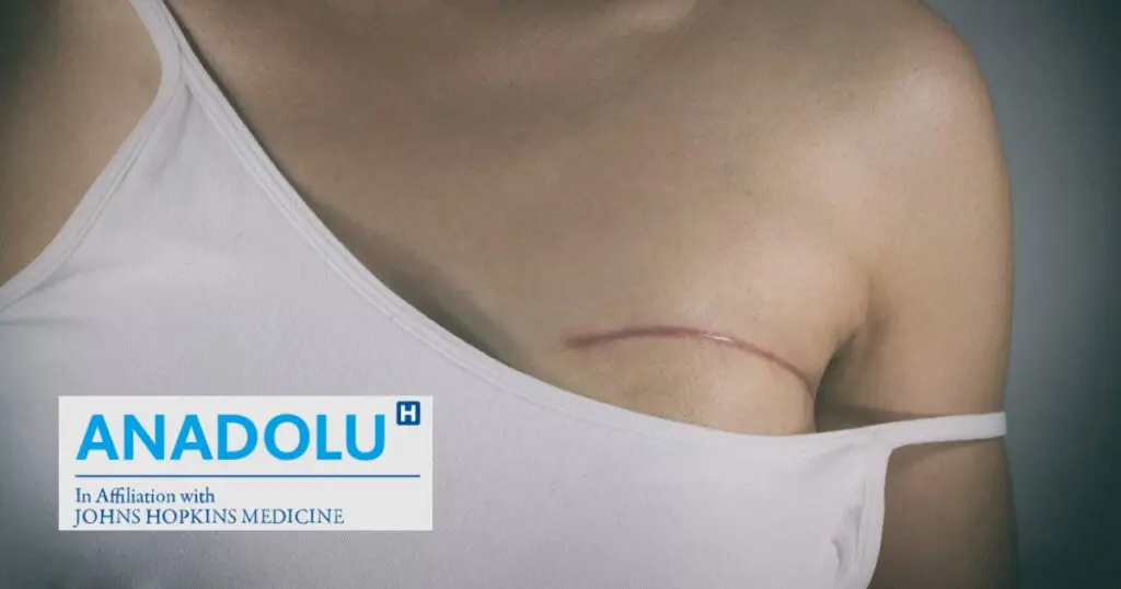 Lumpectomie : la chirurgie mammaire conservatrice du cancer du sein