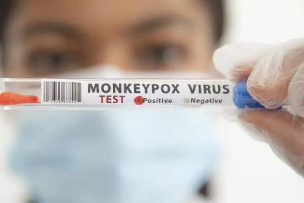 Variole du singe en Algérie : mise en place d’un plan de prévention