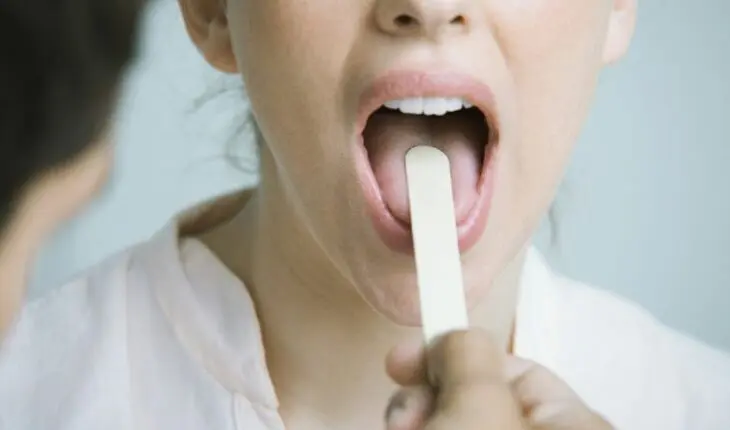 Symptômes du cancer de la langue