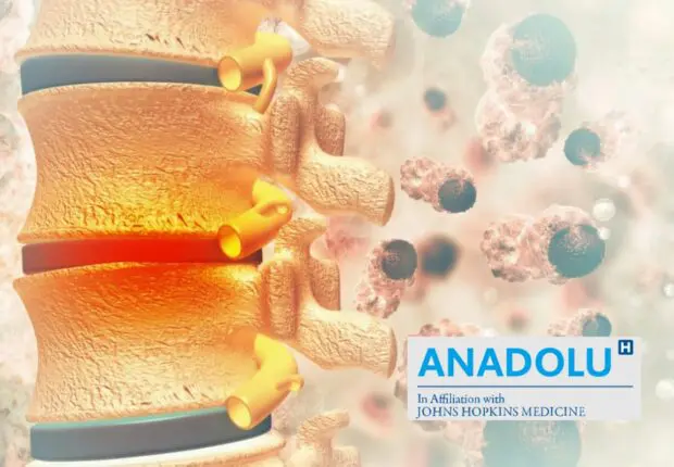 Cancer des os et tumeurs osseuses : Tout comprendre sur cette maladie