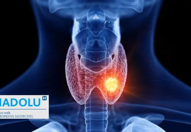 Guérir du cancer de la thyroïde : toutes les options de traitement à votre disposition