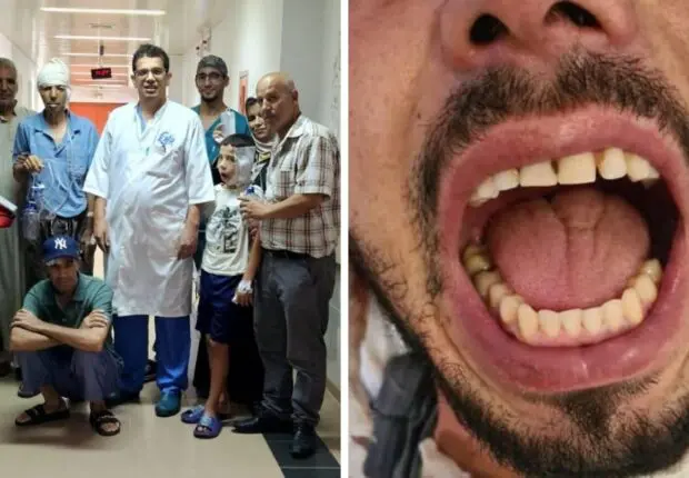 14 ans de silence brisé… Des chirurgiens algériens réalisent une prouesse médicale inédite à Oran