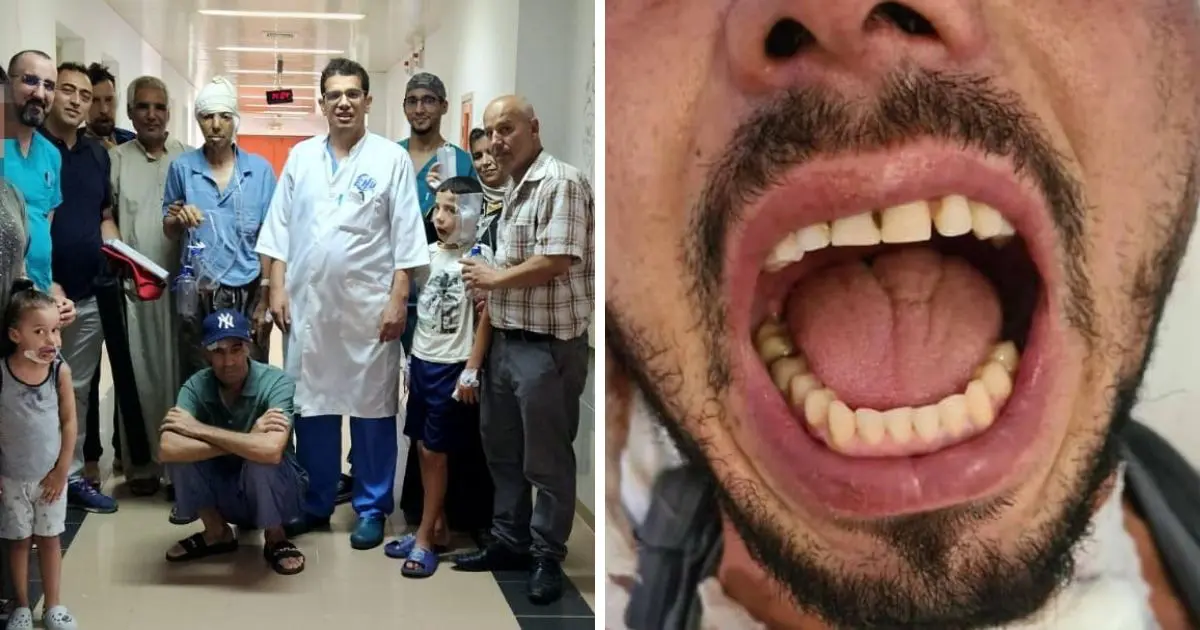 14 ans de silence brisé… Des chirurgiens algériens réalisent une prouesse médicale inédite à Oran