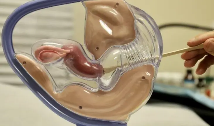 Dépistage du cancer du col de l'utérus