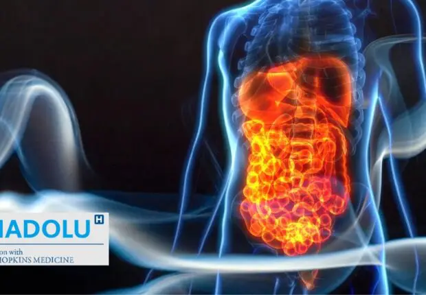 Tout savoir sur les cancers digestif : causes, symptômes, traitements