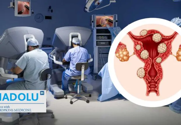 Chirurgie robotique des fibromes : Moins de douleur, récupération plus rapide