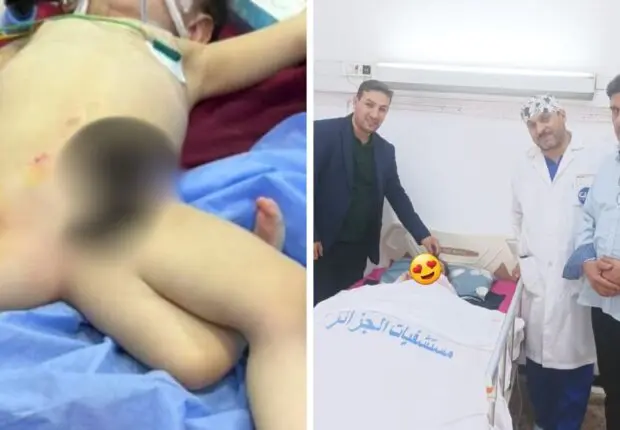 Exploit médical historique en Algérie : Une opération chirurgicale rarissime réalisée avec succès