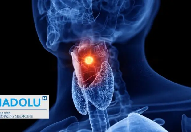 Cancer du larynx – tabac, alcool, voix enrouée persistante : quel lien ?