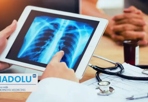 Comprendre les stades du cancer du poumon : un guide simple