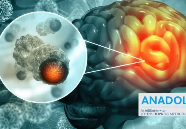 Face au cancer du cerveau : Les armes de la médecine pour vaincre la maladie