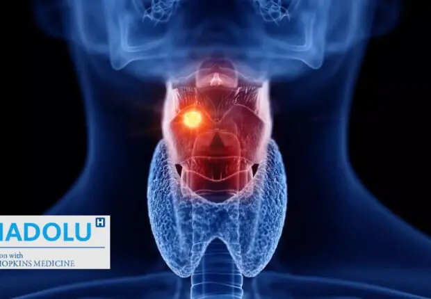 Cancer du nasopharynx : comprendre, prévenir et soigner