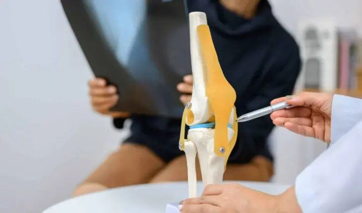 Arthrose du genou