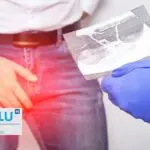 Envies fréquentes d’uriner : maladies associées et solutions thérapeutiques