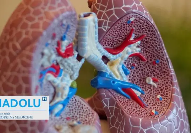 Nouvelles perspectives dans la lutte contre le cancer du poumon