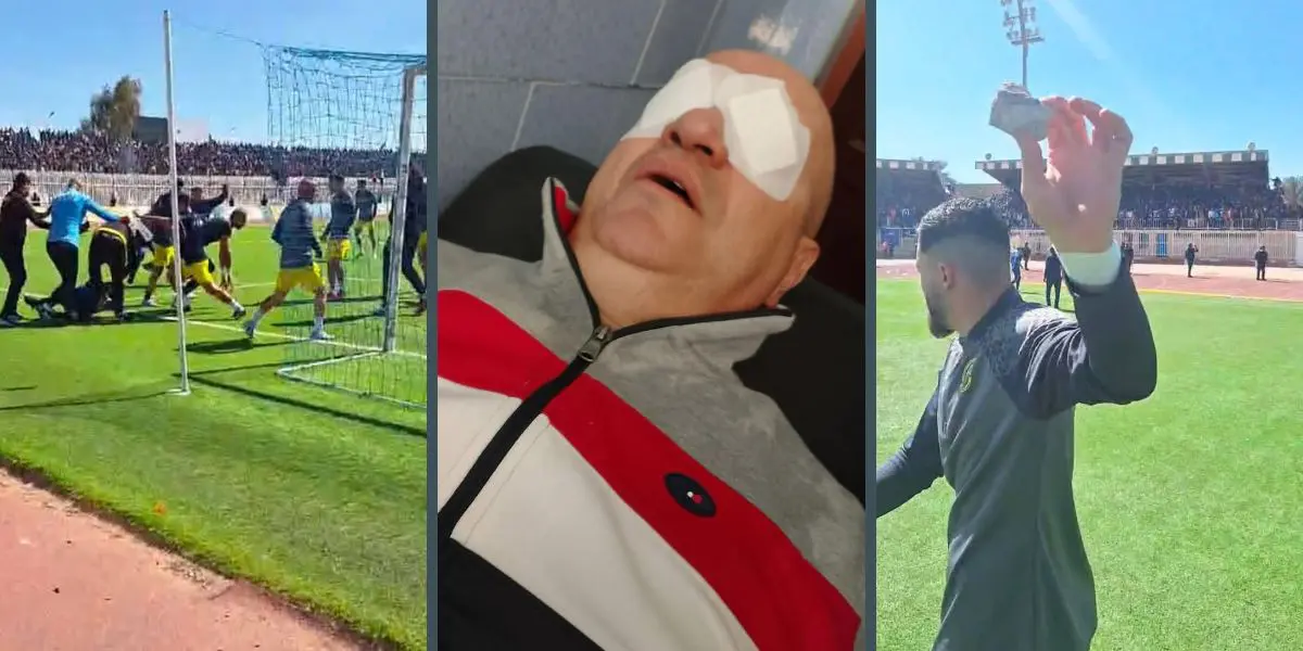 Scènes de hooliganisme, jet de pierres, esprit de sel… le match MBR – USMH n’a pas eu lieu