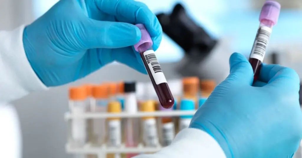 Des analyses médicales « dangereuses » en Algérie : les experts exigent une action urgente