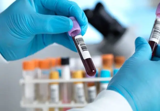 Des analyses médicales « dangereuses » en Algérie : les experts exigent une action urgente