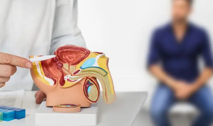 Radiothérapie (IRM) et cancer de la prostate