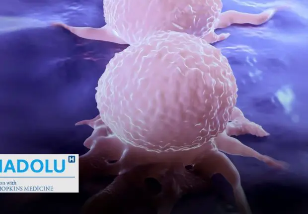 Cancer du sein et mélanome : le rôle décisif de la lymphadénectomie