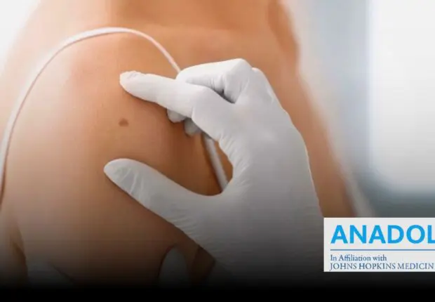 Marges chirurgicales et cancers cutanés : l’essentiel à savoir