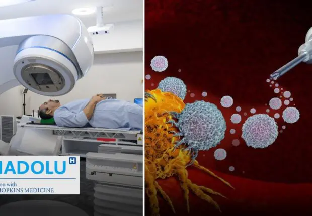 Radiothérapie et immunothérapie : L’alliance révolutionnaire contre le cancer