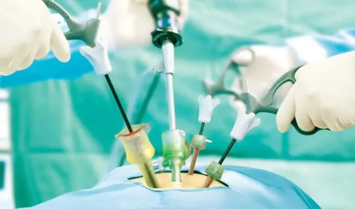 chirurgie laparoscopique de l'abdomen