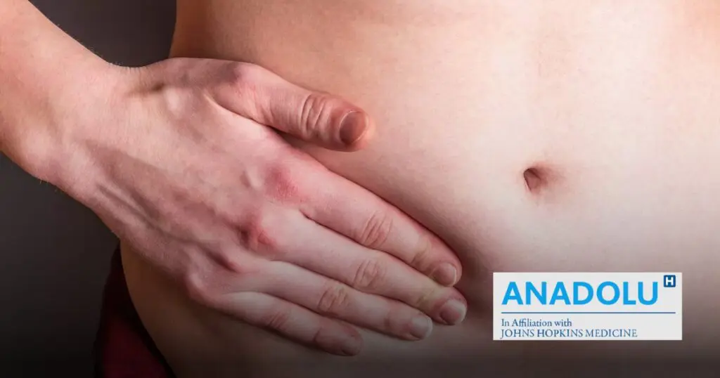 Chirurgie des hernies abdominales : guide complet pour comprendre et traiter