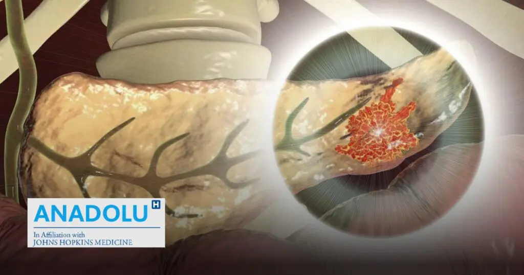Traitement chirurgical des tumeurs neuroendocrines : techniques, suivi et perspectives