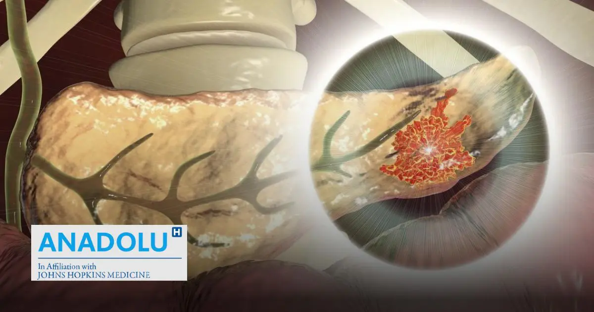 Traitement chirurgical des tumeurs neuroendocrines : techniques, suivi et perspectives