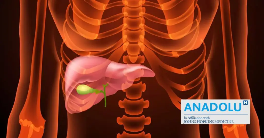Chirurgie de la vésicule biliaire : quand et comment l’ablation devient nécessaire