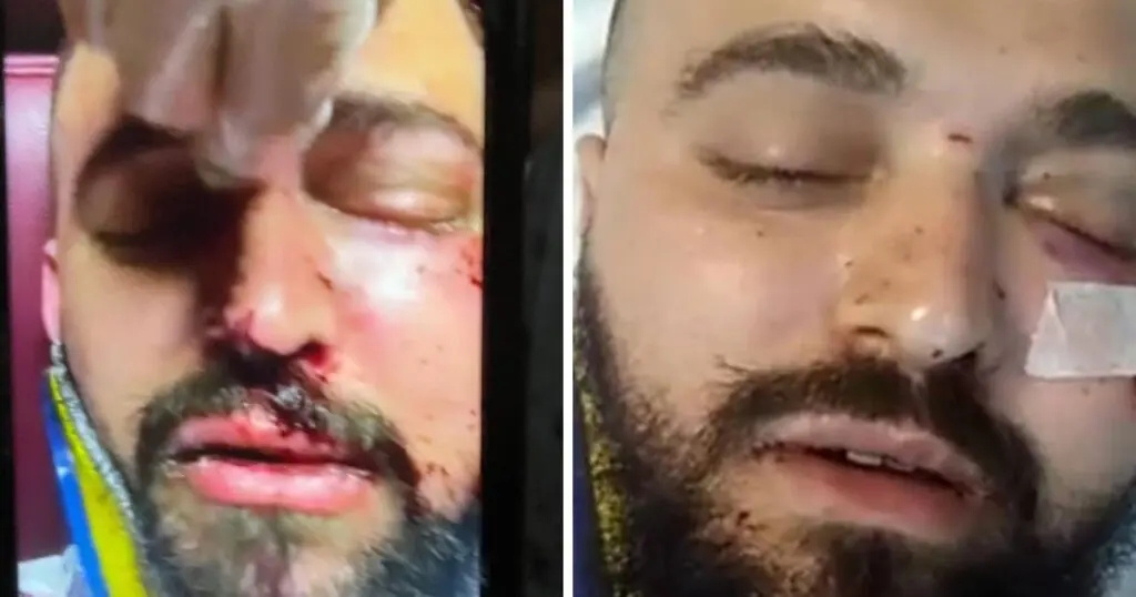 Un Algérien plongé dans le coma après une « violente agression » sur un bateau Corsica