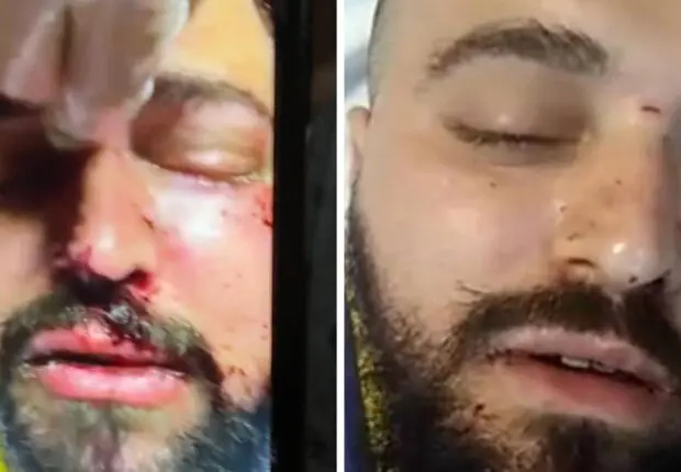 Un Algérien plongé dans le coma après une « violente agression » sur un bateau Corsica