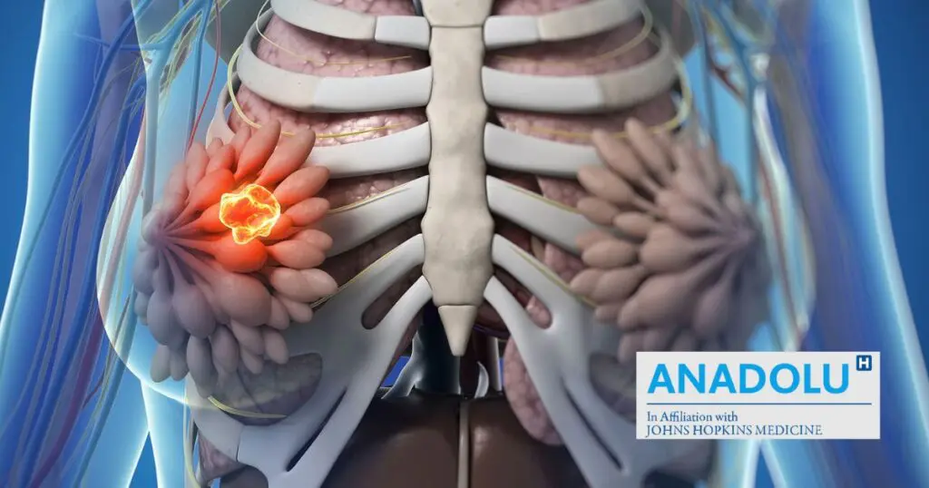 Ménopause : les cancers qui guettent et comment se protéger