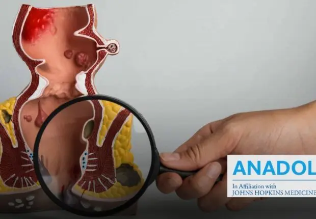 Démystifier les fissures anales : signes révélateurs et traitement efficaces