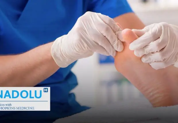 Chirurgie du pied diabétique : quand et quel spécialiste consulter ?